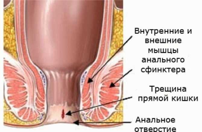Профилактика боли после секса