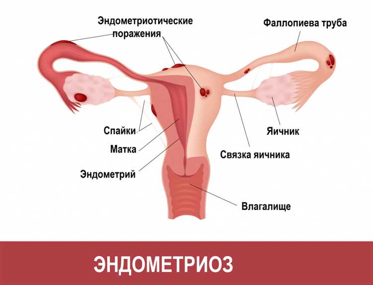 Использование смазки
