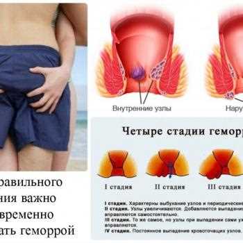 Риск травм и повреждений